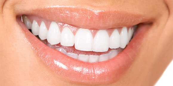 Britesmile Teeth Whitening Britesmile Teeth Whitening