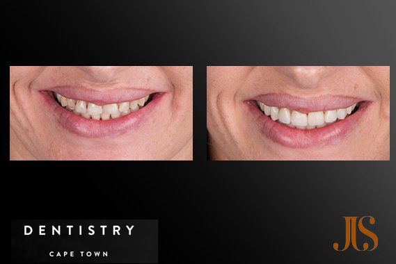 Cape Town Cosmetic Dentistry